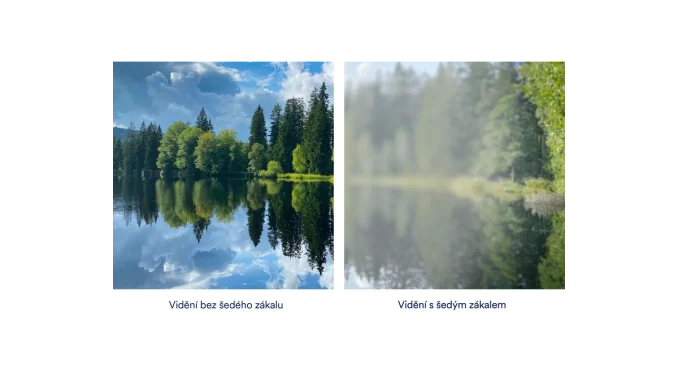 Zrak a jeho překážky: Jak vidí lidé se šedým zákalem?